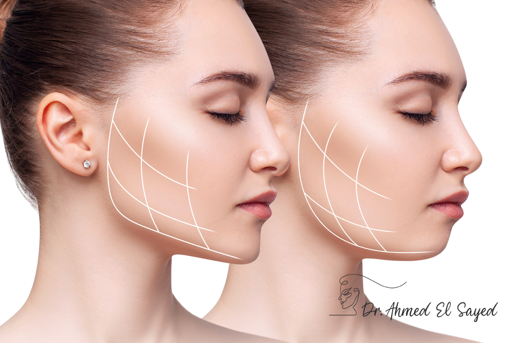 J-Plasma-before-and-after