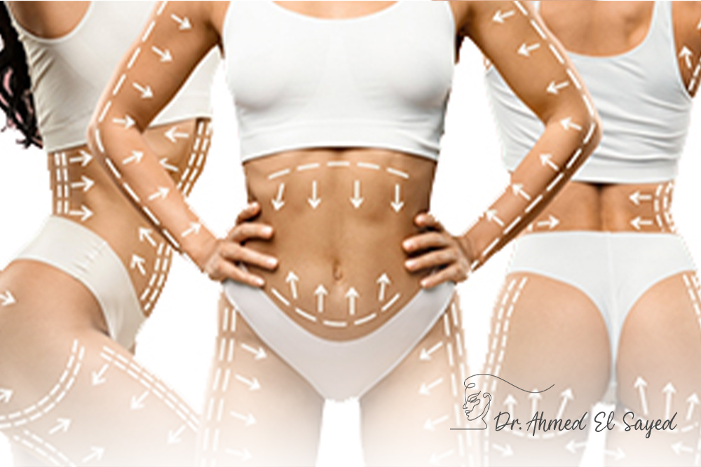 The-Power-of-Combining-Liposuction-with-Other-Body-Contouring-Treatments