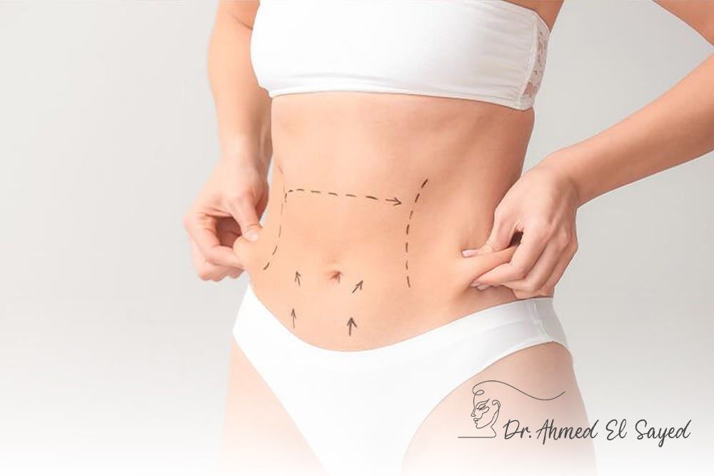 Tips-before-and-after-abdominal-liposuction