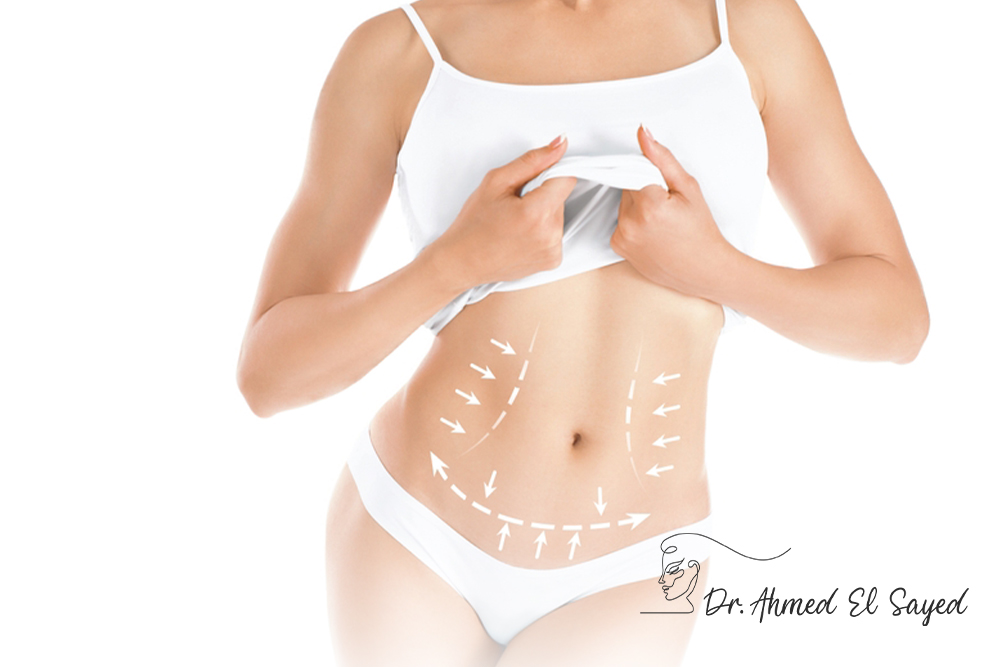 fastest-way-to-tighten-loose-abdominal-skin