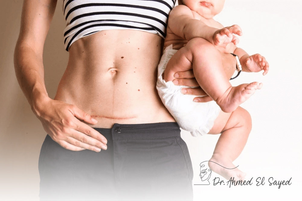 استعيدي-شكل-جسمك-بعد-الولادة-مع-Mommy-Makeover استعيدي-شكل-جسمك-بعد-الولادة-مع-Mommy-Makeover
