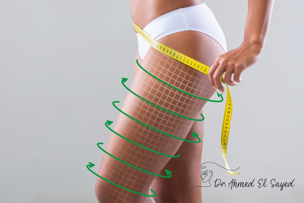 تجربتي-مع-عملية-شد-الأفخاذ تجربتي-مع-عملية-شد-الأفخاذ