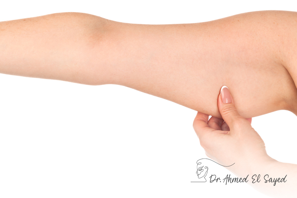 Arm-Lift