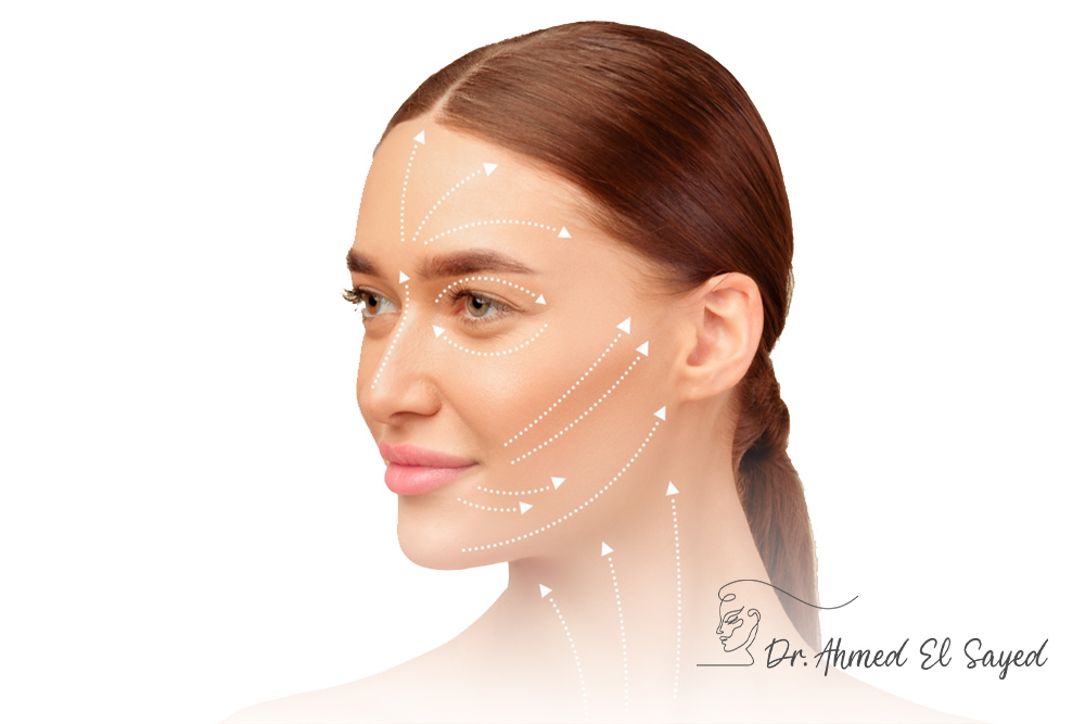 Facelift