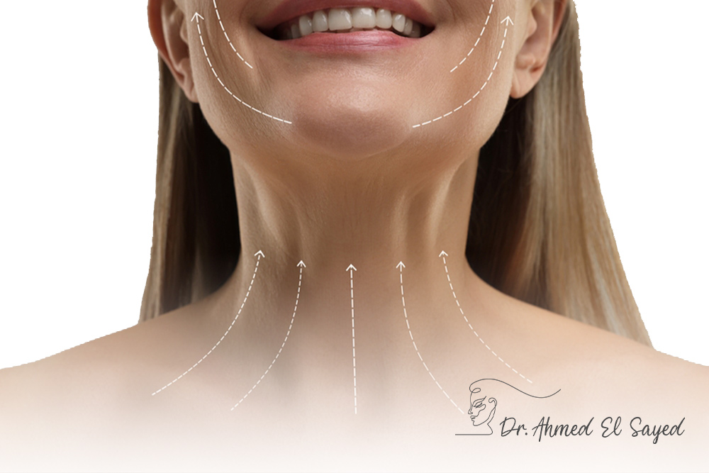 Neck-Lift
