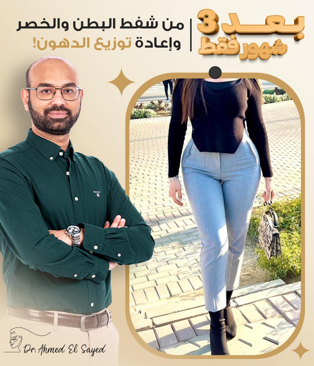 تجربتي مع شفط البطن والخصر