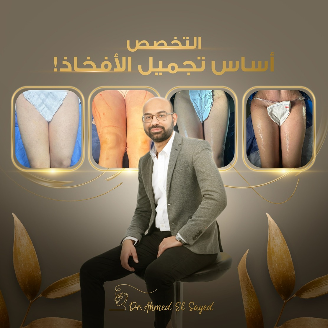 شد ونحت الأفخاذ