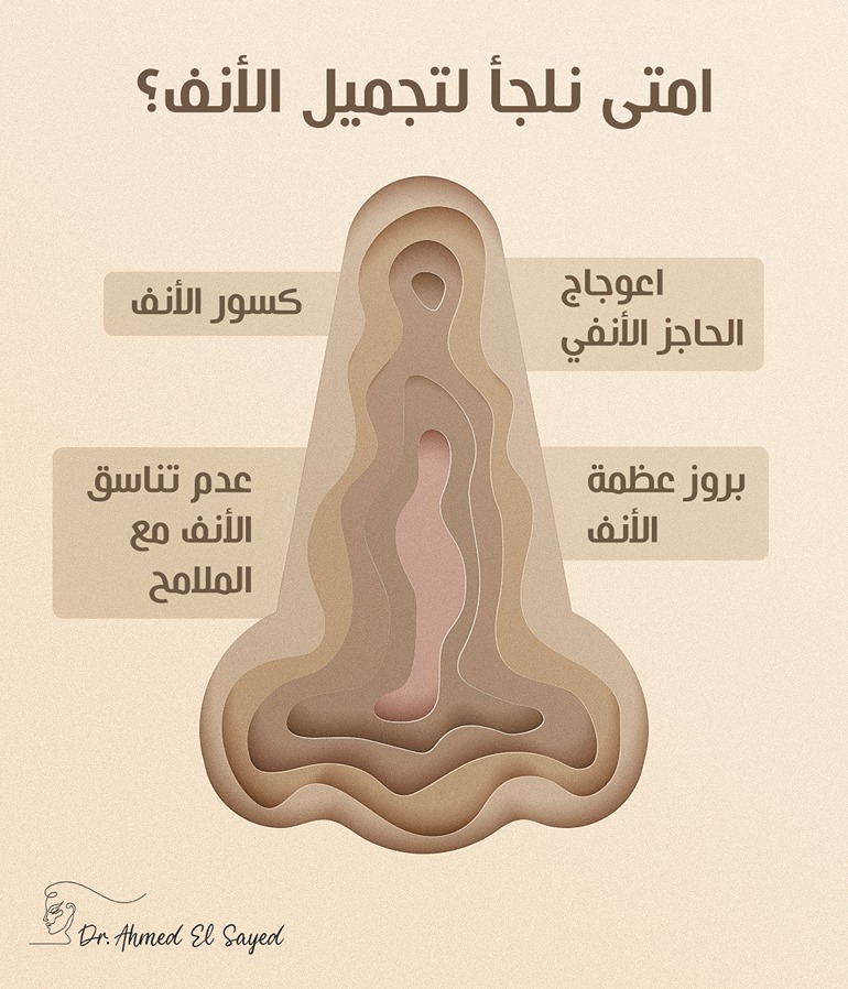 جراحة تجميل الانف